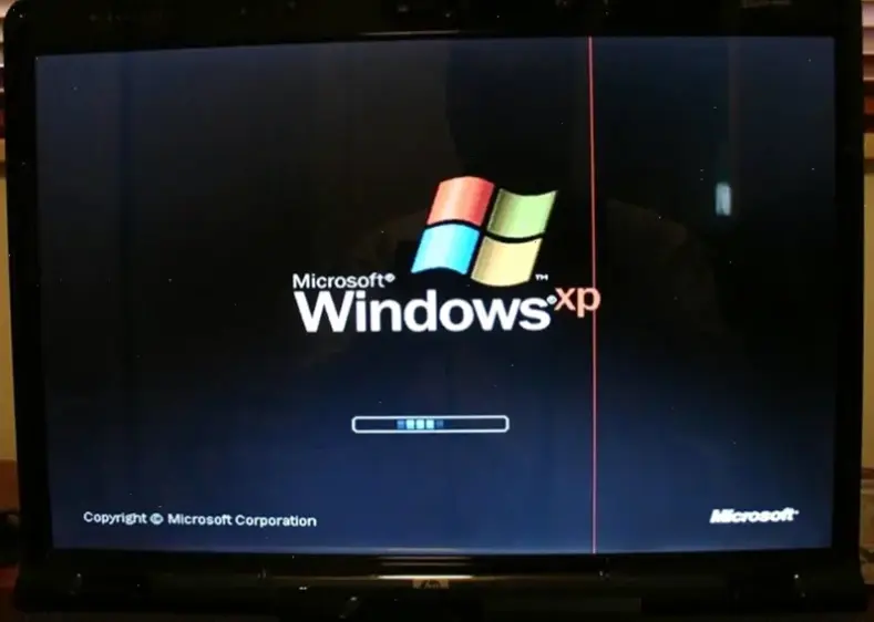 Nguyên nhân chính