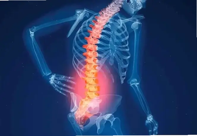 Nguyên nhân suy yếu hệ xương