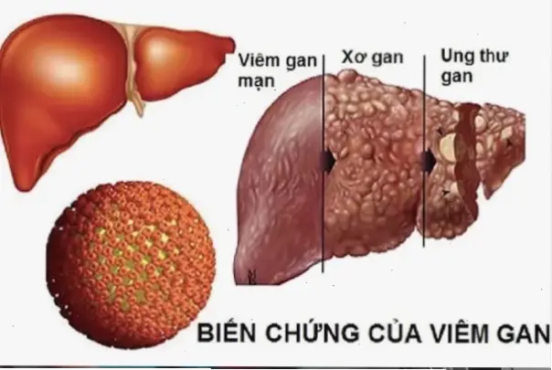 Nguyên nhân và tác động