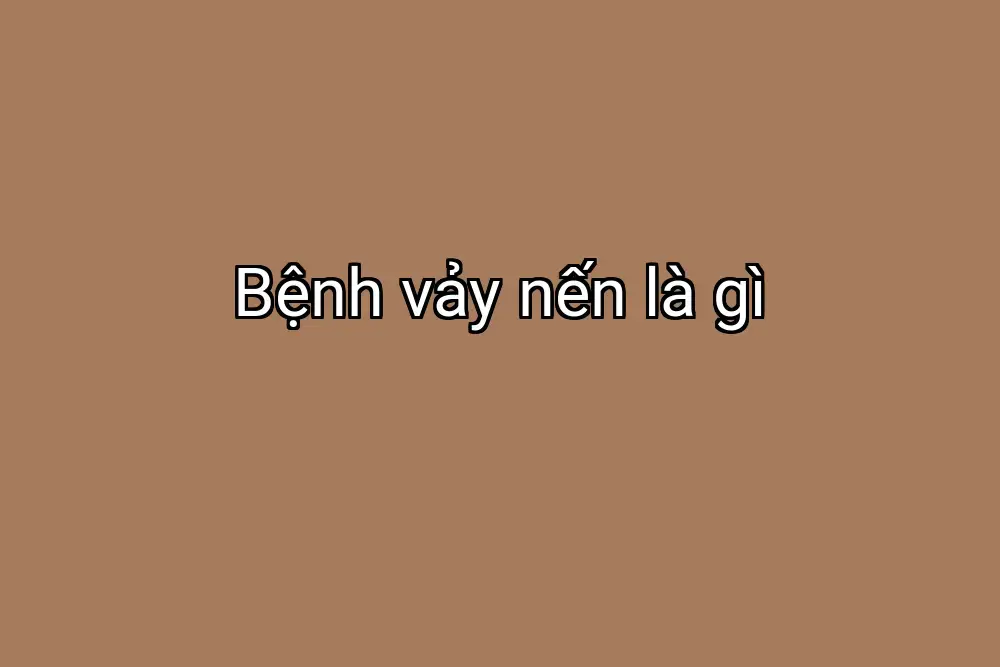 Bệnh vảy nến là gì