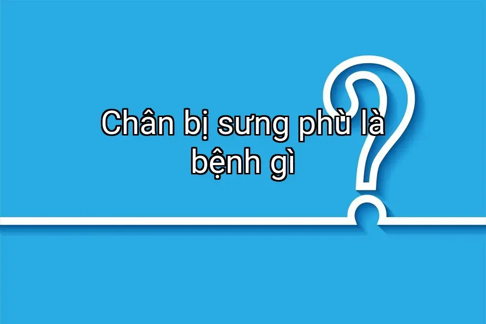 Chân bị sưng phù là bệnh gì