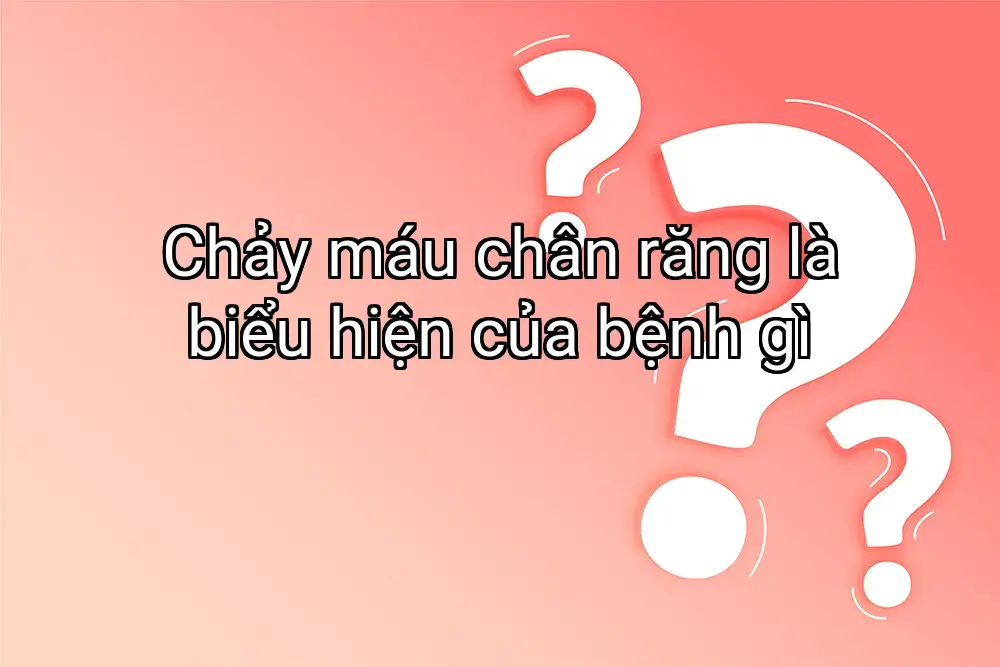 Chảy máu chân răng là biểu hiện của bệnh gì