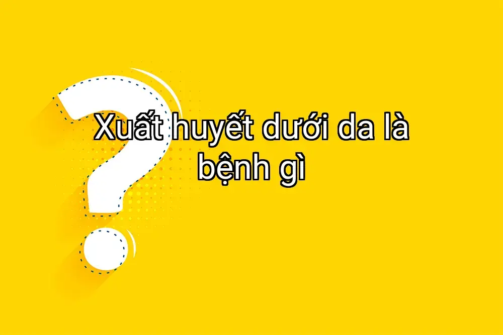 Xuất huyết dưới da là bệnh gì